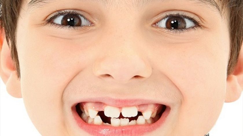 Nằm mơ thấy rụng răng thì có bị làm sao không?